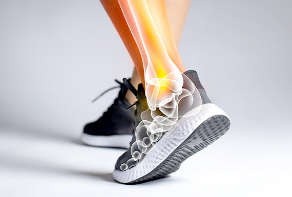 Ankle Sprain in Singapore