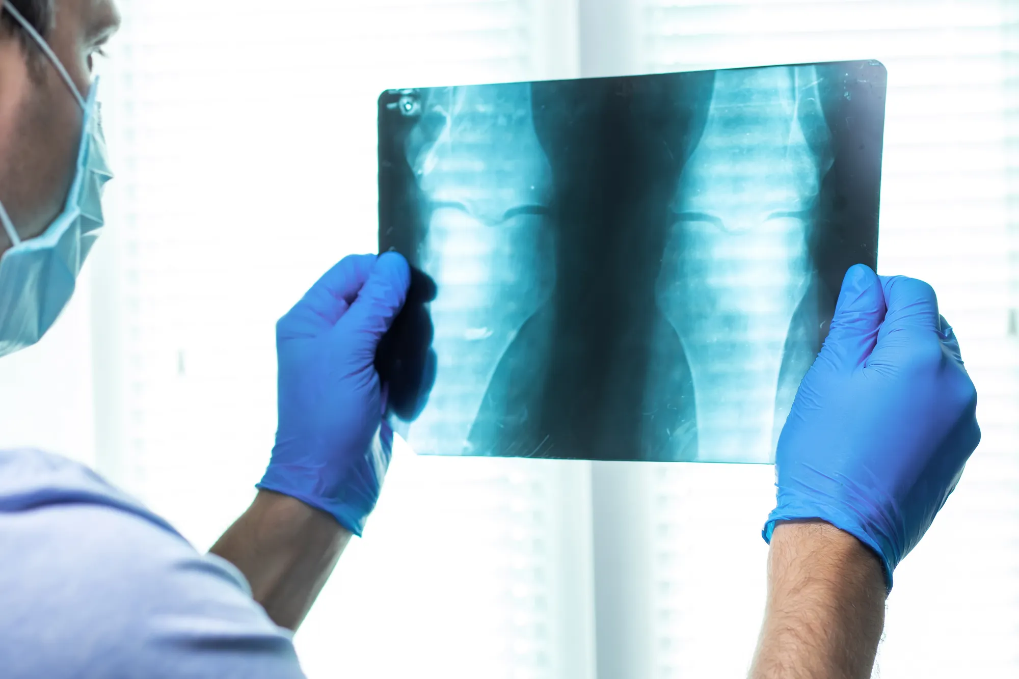 Specialist reviewing scan for chronic pain.
